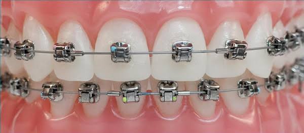Ortodonti randevusu nasıl alınır 3